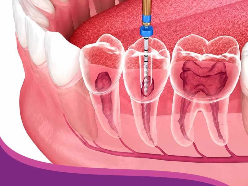 Endodoncia Consultorio Yaz Endodental