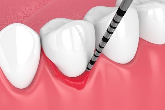 Periodoncia Periodoncia - Consultorio Yaz Endodental