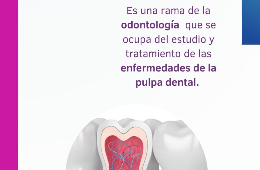 ¿Qué es la endodoncia?