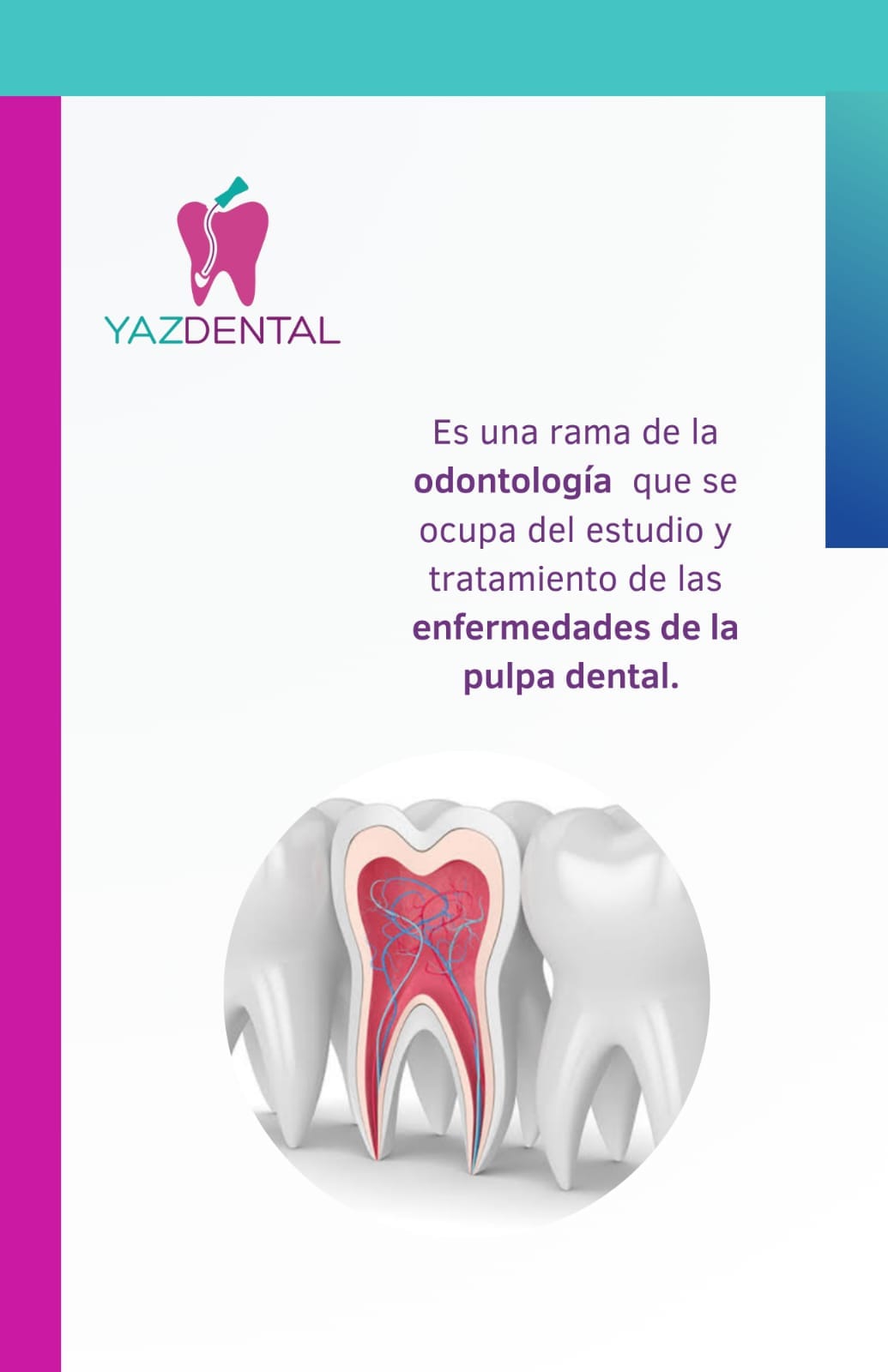 ¿Qué es la endodoncia?